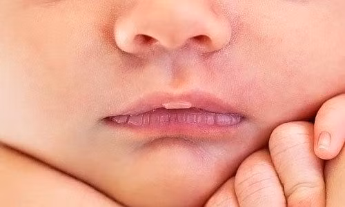 Các phụ huynh không nên tự ý bôi những sản phẩm thiên nhiên lên làn da của bé. Ảnh minh họa