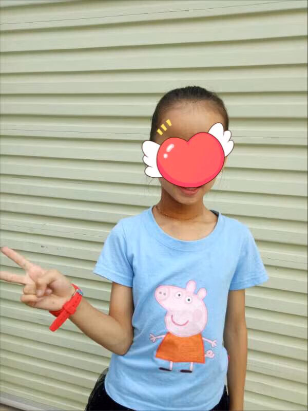 Bệnh nhân sau mổ 7 ngày