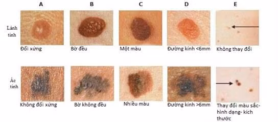 Ảnh: Bệnh viện K.