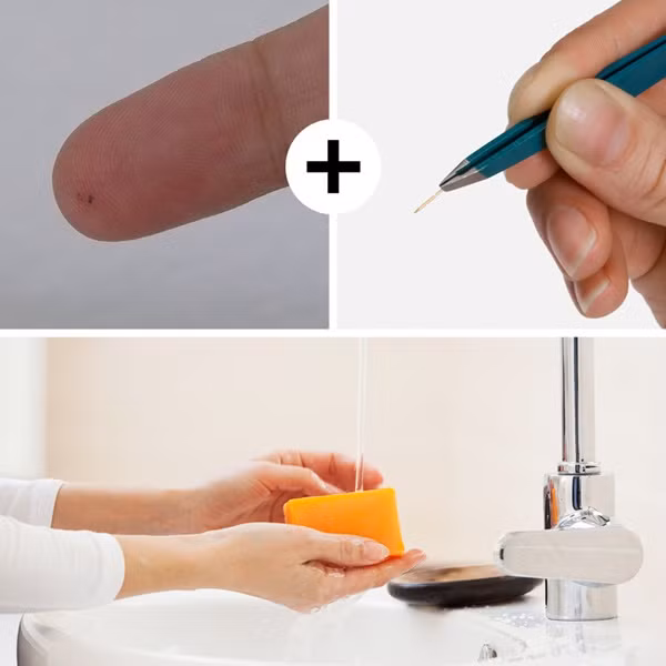 10 mẹo sơ cứu nhất định phải biết, có thể giúp bạn thoát chết trong gang tấc-7