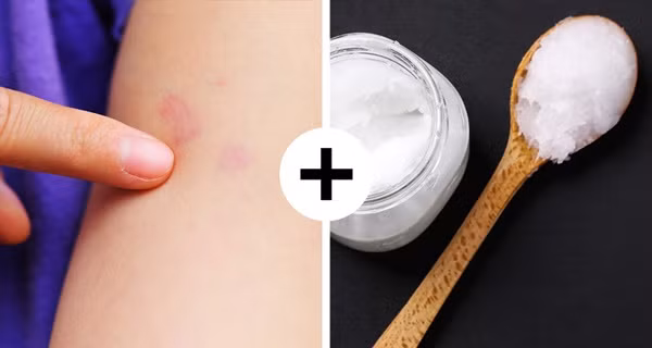 10 mẹo sơ cứu nhất định phải biết, có thể giúp bạn thoát chết trong gang tấc-8