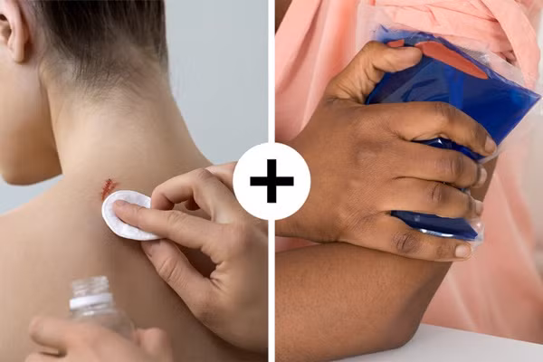 10 mẹo sơ cứu nhất định phải biết, có thể giúp bạn thoát chết trong gang tấc-2
