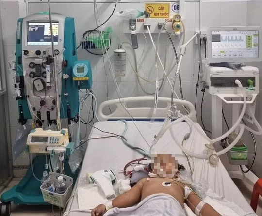 Bệnh nhi mắc tay chân miệng nặng được Bệnh viện Đa khoa Bạc Liêu hội chẩn từ xa với Bệnh viện Nhi đồng 1 (TPHCM)để điều trị. 