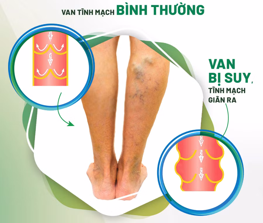 Minh họa/INT