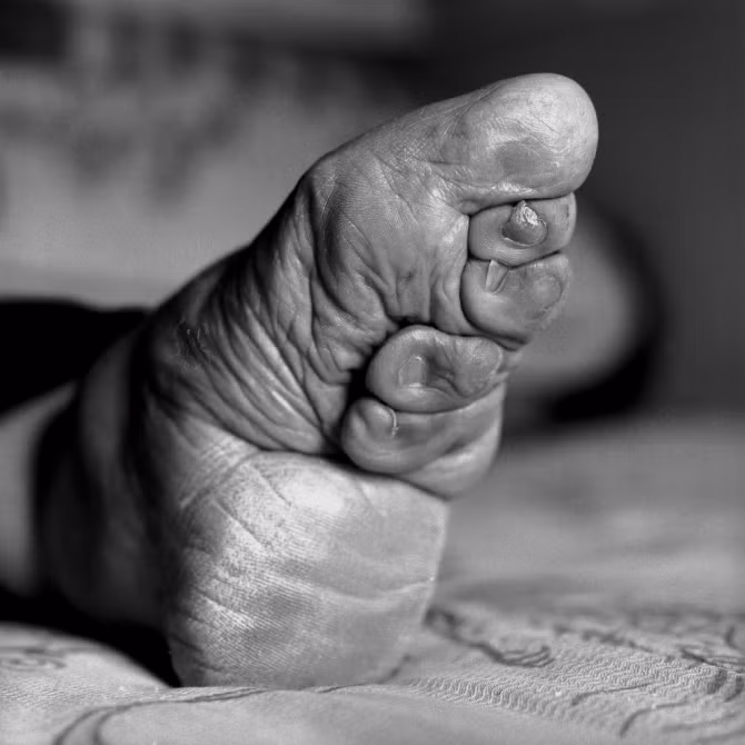 Chuyện những phụ nữ cuối cùng mang đôi chân gót sen - Ảnh 1