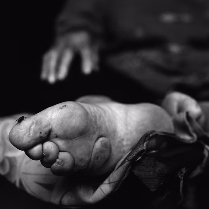 Chuyện những phụ nữ cuối cùng mang đôi chân gót sen - Ảnh 12