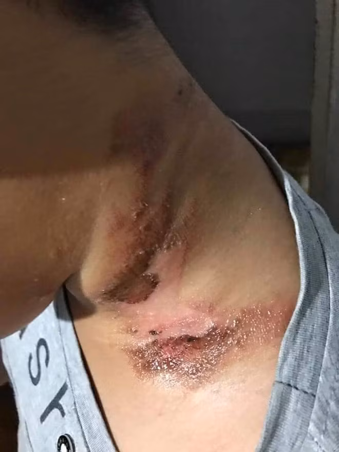 Người dân Kon Tum lùng sục loài bọ lạ bán cho thương lái xuất sang Trung Quốc ảnh 1 Người dân lùng sục loài bọ lạ bán cho thương lái xuất sang Trung Quốc - ảnh 1
