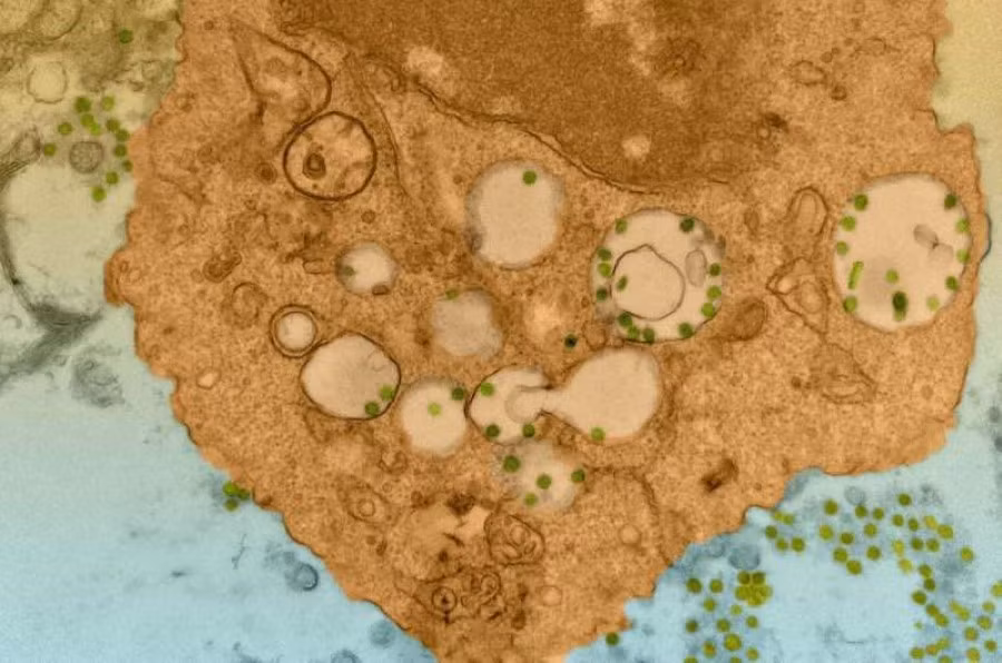 Sự đa dạng của đại thực bào giúp bảo vệ cơ thể khỏi virus. 