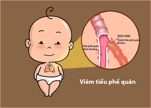 Minh họa/INT Minh họa/INT