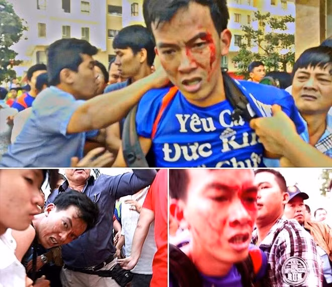 Anh Sơn bị đánh chảy máu đầu. Ảnh: Người dân cung cấp. Những người tấn công cư dân chung cư cao cấp là ai?