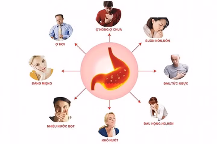 Một số lưu ý khi điều trị bệnh trào ngược dạ dày thực quản