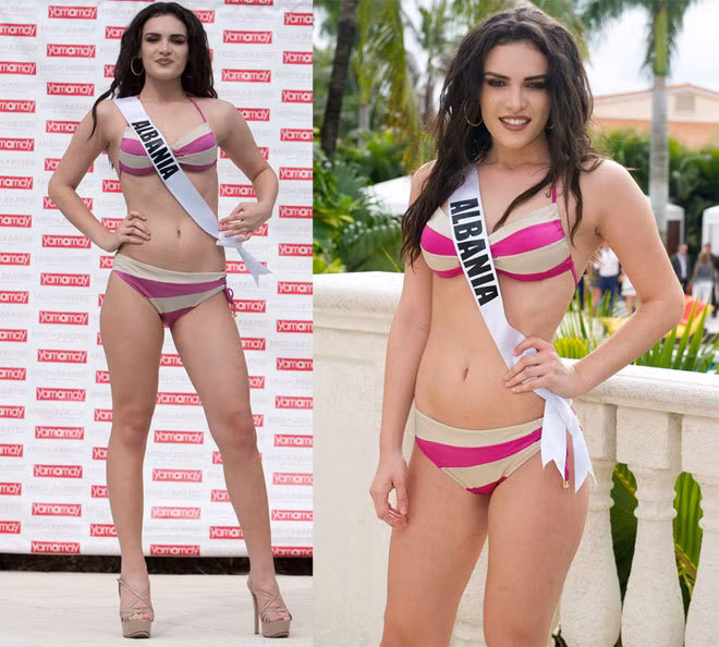 Thí sinh Miss Universe 2014 eo bánh mì, vai đòn gánh ảnh 7