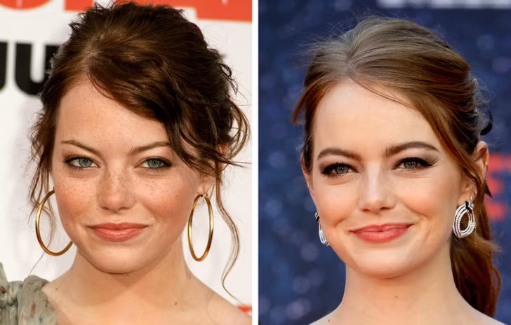 Emma Stone