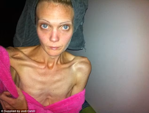 Ms Cahill said her mother sent her a letter to tell her and she was shocked and disgusted when she found out. Later she developed anorexia and dropped to 34kg at her worst
