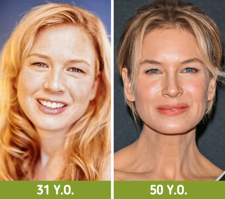 Renee Zellweger.