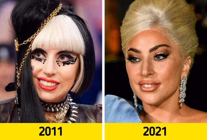 Lady Gaga. Lady Gaga.
