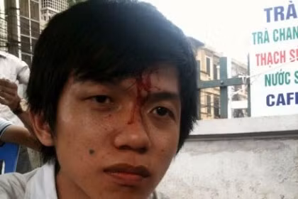“Gã khổng lồ” Thiên Ngọc Minh Uy và những lùm xùm trong quá trình hoạt động ảnh 1 “Gã khổng lồ” Thiên Ngọc Minh Uy và những lùm xùm trong quá trình hoạt động ảnh 1