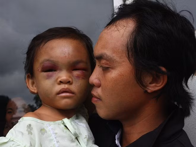 Anh Tố bế bé Ngân khi còn đang điều trị tại bệnh viện.