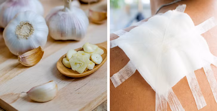 dùng tỏi để chữa lành vết thương