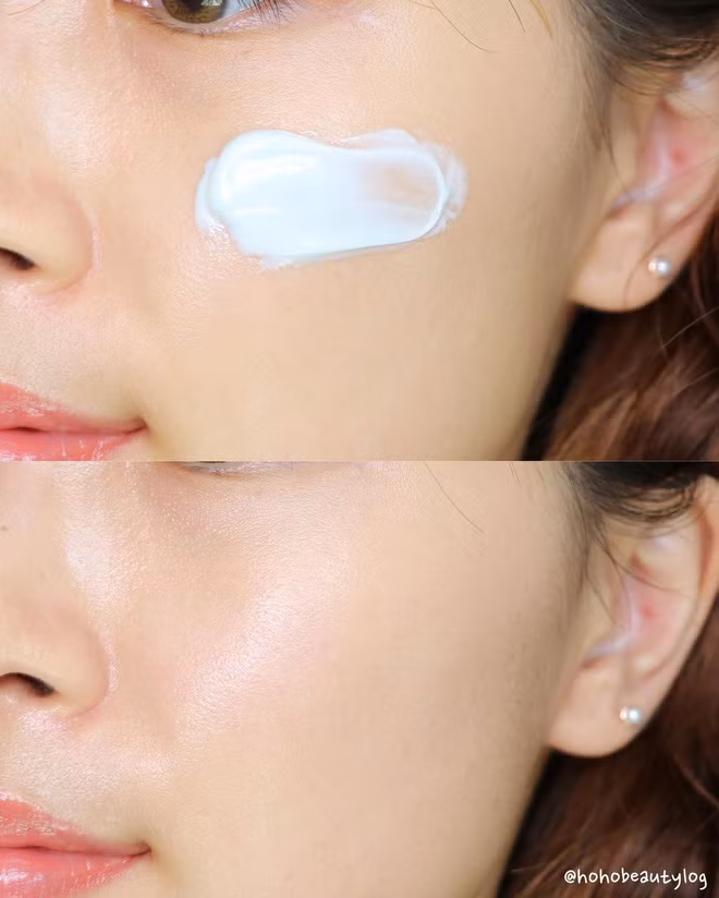 Những sai lầm skincare khiến mụn nổi hoài không hết ảnh 3 Những sai lầm skincare khiến mụn nổi hoài không hết ảnh 3