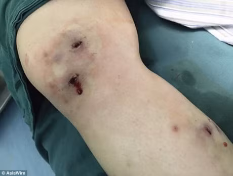 Co gai kinh hai khi chung kien con gioi chui ra tu chan minh - Anh 2