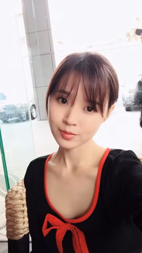 Nghi van phau thuat tham my va phong cach thoi trang sen sam, day la cau tra loi cua Midu - Anh 1