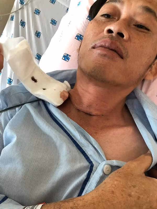Nghệ sĩ Hoài Linh mắc ung thư tuyến giáp phải nhập viện để điều trị.