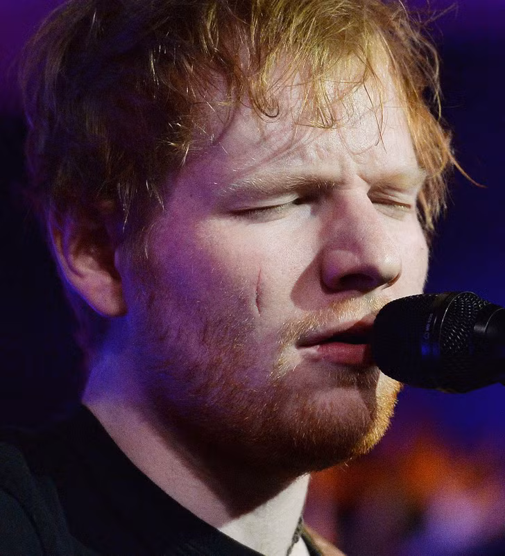 Ed Sheeran: Anh đã được đưa vào bệnh viện sau khi Công chúa Beatrice của xứ York vung lưỡi kiếm nghi lễ ngược về phía sau vai mình mà không nhận ra đó là vị trí đứng của nam ca sĩ. Sau đó, anh nhanh chóng được đưa đến bệnh viện và có thể tiếp tục trở lại sân khấu. Ed Sheeran: Anh đã được đưa vào bệnh viện sau khi Công chúa Beatrice của xứ York vung lưỡi kiếm nghi lễ ngược về phía sau vai mình mà không nhận ra đó là vị trí đứng của nam ca sĩ. Sau đó, anh nhanh chóng được đưa đến bệnh viện và có thể tiếp tục trở lại sân khấu.