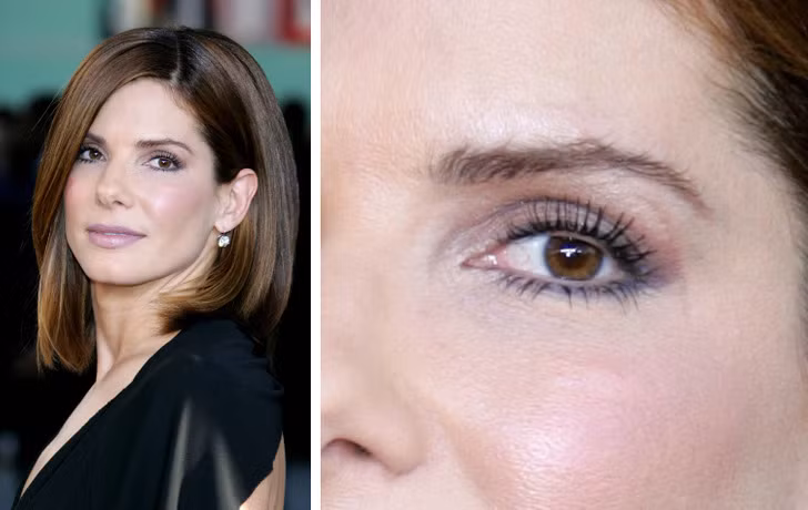 Sandra Bullock: Nữ diễn viên có một vết sẹo nhỏ gần mắt trái do khi còn là một thiếu niên cô đã bị trượt chân ngã xuống hồ và đập đầu vào một tảng đá. Sau đó, vết cắt nhỏ đã để lại sẹo trên đuôi mắt. Sandra Bullock: Nữ diễn viên có một vết sẹo nhỏ gần mắt trái do khi còn là một thiếu niên cô đã bị trượt chân ngã xuống hồ và đập đầu vào một tảng đá. Sau đó, vết cắt nhỏ đã để lại sẹo trên đuôi mắt.