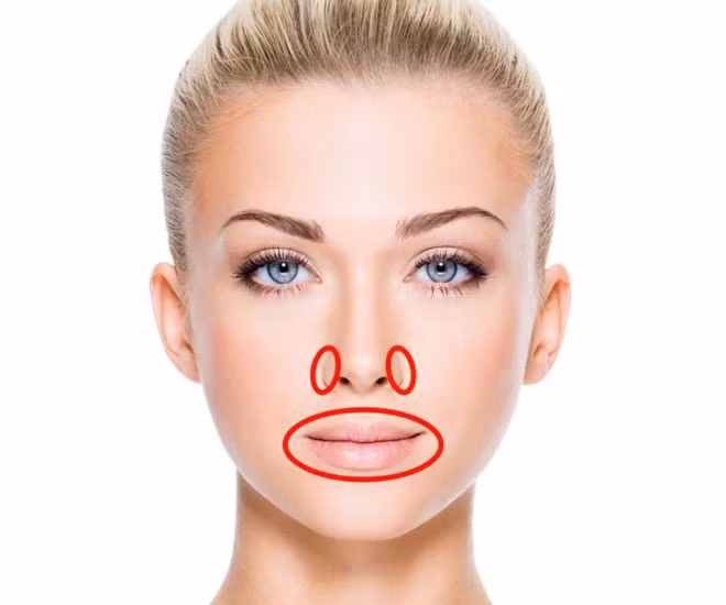 Bong da quanh miệng và mũi có thể do cơ thể thiếu các vitamin cần thiết như A, C, E, hoặc B. Bong da thường đi kèm với sự mệt mỏi, suy giảm tập trung hoặc chú ý, rụng tóc, và móng tay yếu. Bạn cần xem lại chế độ ăn uống và bổ sung thêm các loại thực phẩm phù hợp.
