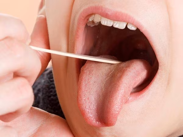 10 công dụng như thần dược của nước ép khoai tây - Ảnh 3