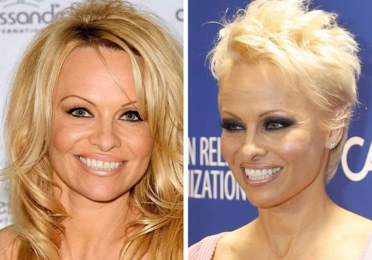 Pamela Anderson.