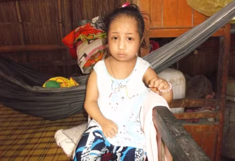 Soc: Be gai 14 tuoi chi cao 40cm va nang 9kg o Vinh Long - Anh 4