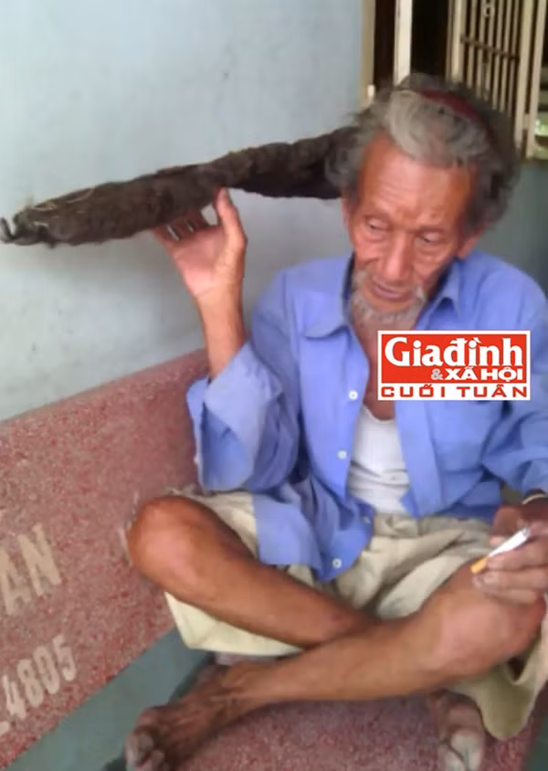 Chuyện lạ về ông lão "tóc kết rồng" sau 9 ngày đêm bất tỉnh ảnh 1