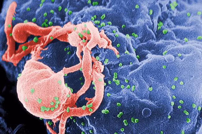Những loại virus gây chết người kinh khủng nhất mọi thời đại - Ảnh 5.