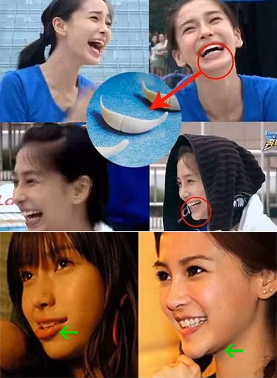 Angelababy. 7 sao nữ châu Á có gương mặt cứng đơ vì thẩm mỹ