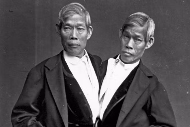 Quê hương của cặp sinh đôi dính liền đầu tiên nổi tiếng thế giới: Eng và Chang sinh năm 1811 ở ngoại ô Bangkok, thời đó Thái Lan có tên Siam. Vì vậy mà thuật ngữ “Siamese twins” (cặp sinh đôi dính liền) đã ra đời và được sử dụng tới ngày nay. Eng và Chang theo rạp xiếc P.T. Barnum chu du khắp thế giới và cuối cùng chuyển tới Mỹ, nơi cả hai người kết hôn, sinh con và sống tới 62 tuổi. Quê hương của cặp sinh đôi dính liền đầu tiên nổi tiếng thế giới: Eng và Chang sinh năm 1811 ở ngoại ô Bangkok, thời đó Thái Lan có tên Siam. Vì vậy mà thuật ngữ “Siamese twins” (cặp sinh đôi dính liền) đã ra đời và được sử dụng tới ngày nay. Eng và Chang theo rạp xiếc P.T. Barnum chu du khắp thế giới và cuối cùng chuyển tới Mỹ, nơi cả hai người kết hôn, sinh con và sống tới 62 tuổi.