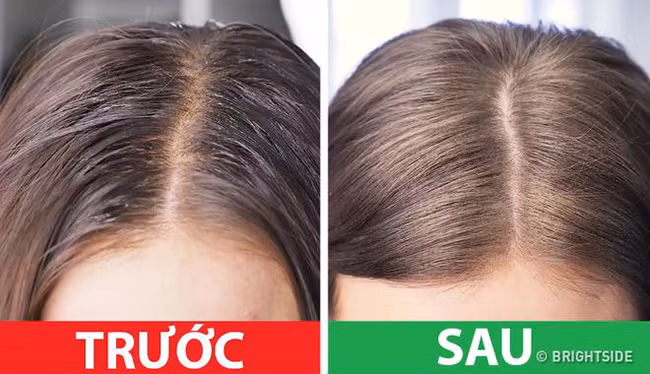 16 mẹo hay cứu nguy chị em trong những tình huống “dở khóc dở cười”