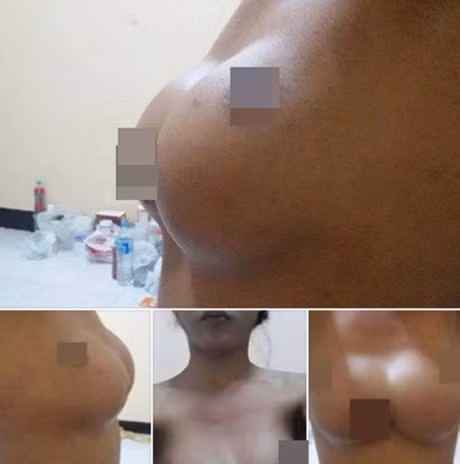 Soc voi nhung ca phau thuat hong, muon hoi han cung khong con co hoi - Anh 14