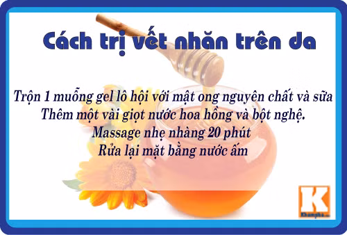 8 cach tri da nhan nheo don gian ma hieu qua tu lo hoi - 4