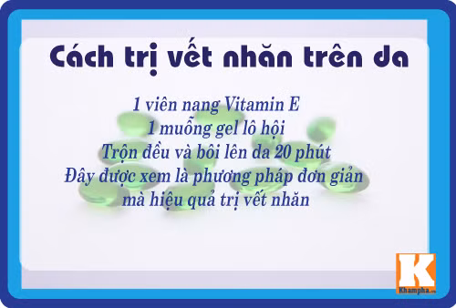 8 cach tri da nhan nheo don gian ma hieu qua tu lo hoi - 8