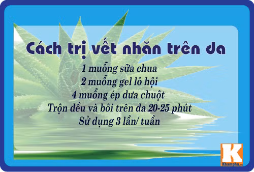 8 cach tri da nhan nheo don gian ma hieu qua tu lo hoi - 6