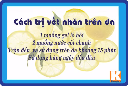 8 cach tri da nhan nheo don gian ma hieu qua tu lo hoi - 2