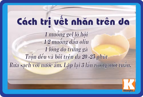8 cach tri da nhan nheo don gian ma hieu qua tu lo hoi - 5