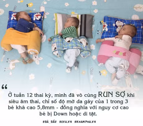 Me tre Ha Noi mang thai 3 hiem gap, ca the gioi 200 trieu ca moi co - Anh 5
