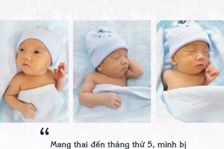 Mẹ trẻ Hà Nội mang thai 3 hiếm gặp, cả thế giới 200 triệu ca mới có