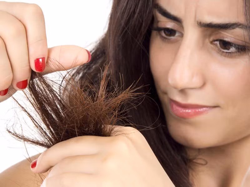Thói quen tai hại khiến rụng tóc hói đầu, đa số người Việt vẫn làm hằng ngày