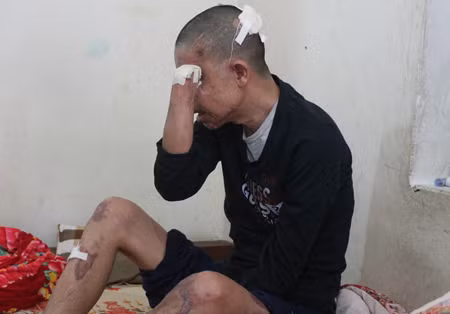 Anh Hảo không thể tự chăm sóc được bản thân mình.