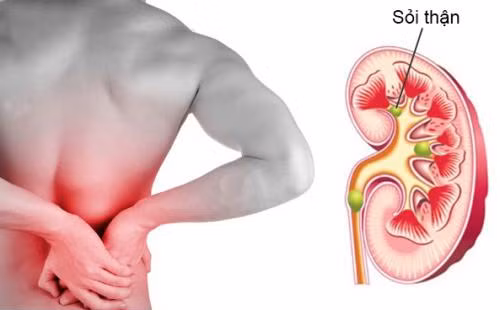 Thói quen nhịn tiểu: Hàng loạt tác hại đáng sợ đang chờ bạn đấy! ảnh 4