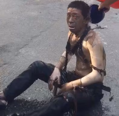 Nguoi dan xot xa ke lai khoanh khac cu ba ban nuoc va chong ngoi xe lan boc chay vi no bot dien - Anh 1